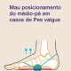 Meia Corretora Tape Sox Pés Valgus Controlo de Pronação - Correção Forte